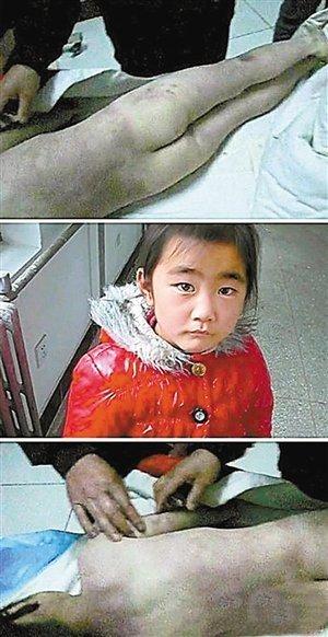 <em>残忍</em>继母<em>虐待</em>继女致死:弄死她也判不了我死刑