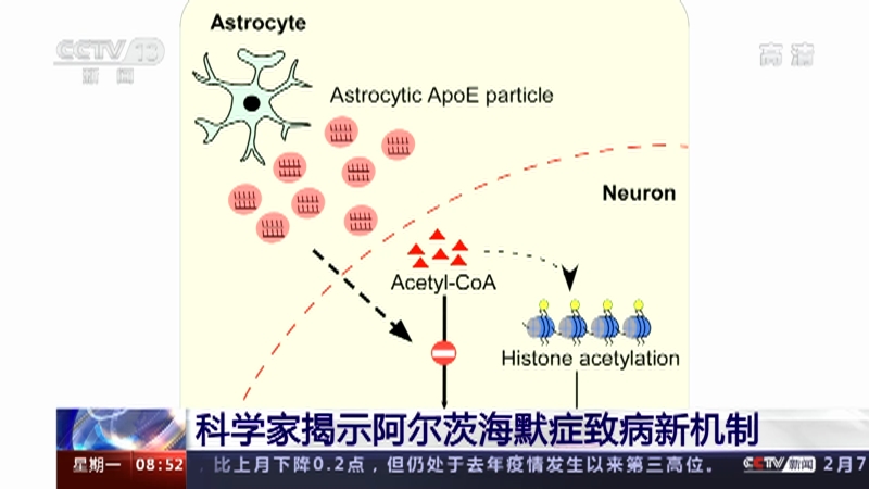 [朝闻天下]科学家揭示阿尔茨海默症致病新机制_CCTV节目官网-CCTV-13_央视网(cctv.com)