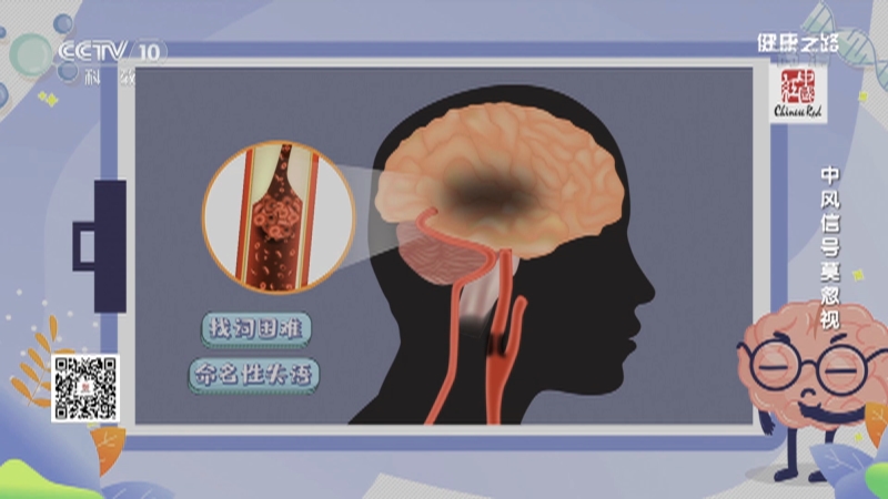 [健康之路]中风信号莫忽视 脑中风的早期信号：说不清_CCTV节目官网-CCTV-10_央视网(cctv.com)