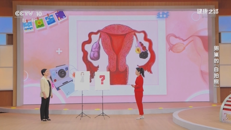[健康之路]卵巢的“自拍照” 警惕“巧克力酱”——巧克力囊肿_CCTV节目官网-CCTV-10_央视网(cctv.com)