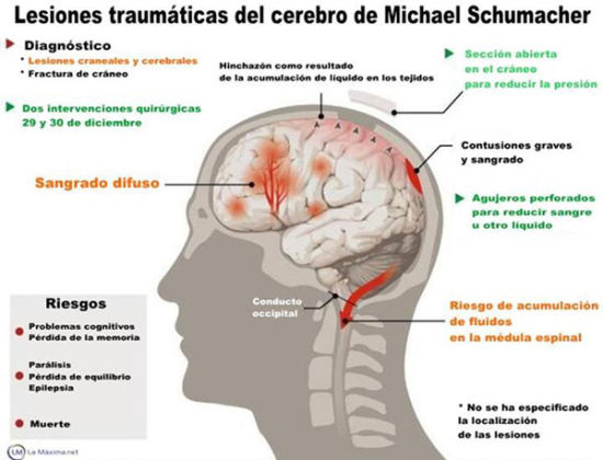 西班牙媒体图解舒马赫伤势