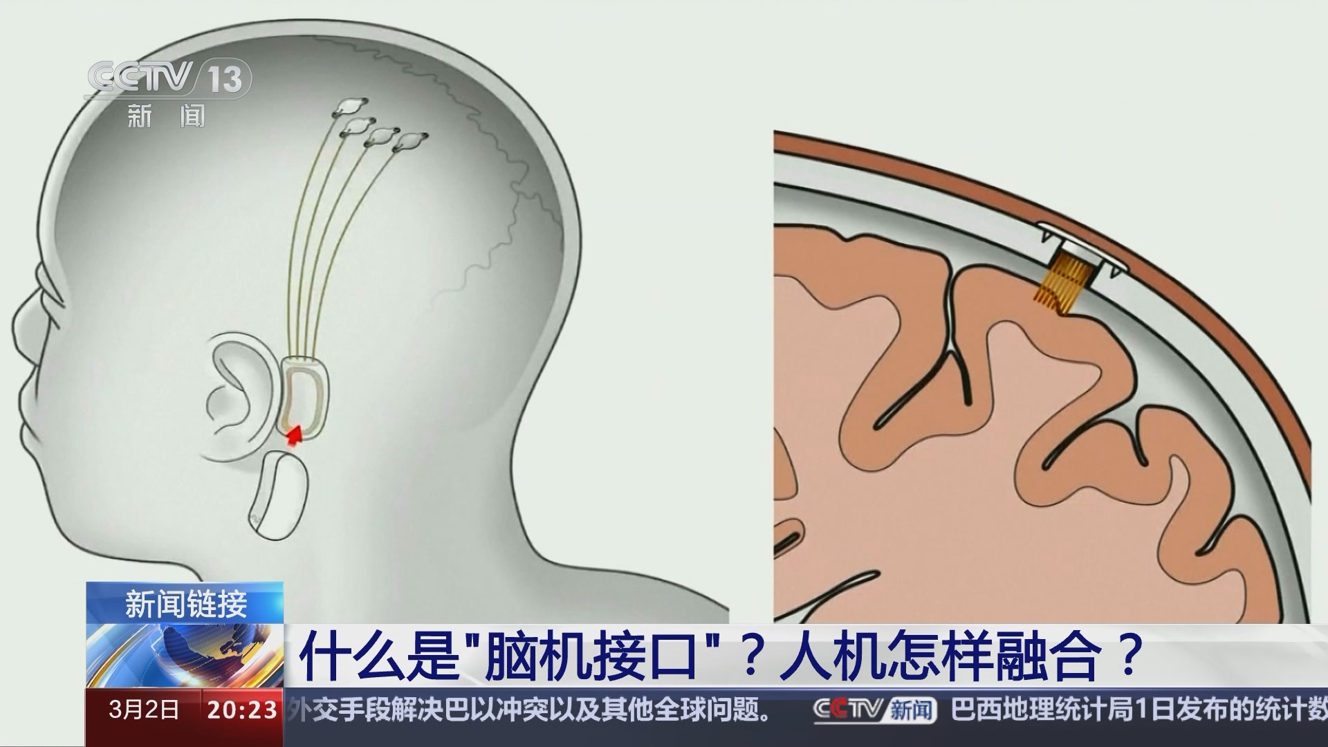 脑机接口意识永生图片