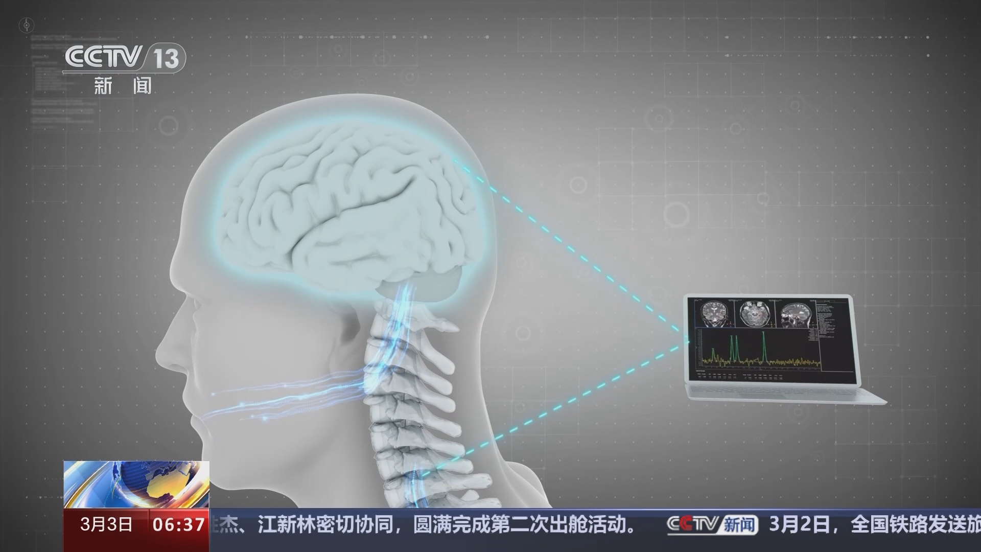 [朝闻天下]我国科研团队成功进行无线微创脑机接口临床试验 "脑机接口