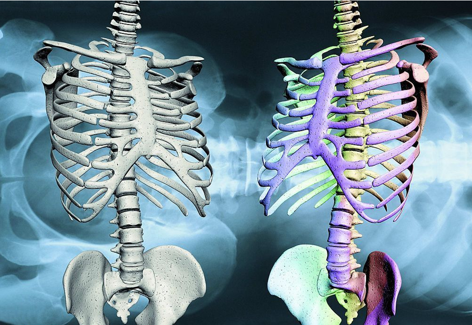    