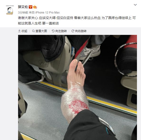 郭艾伦晒右脚受伤照片应该没大碍疼也得继续上