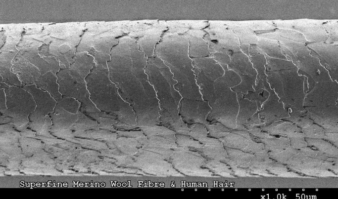 电子显微镜下头发上的毛鳞片